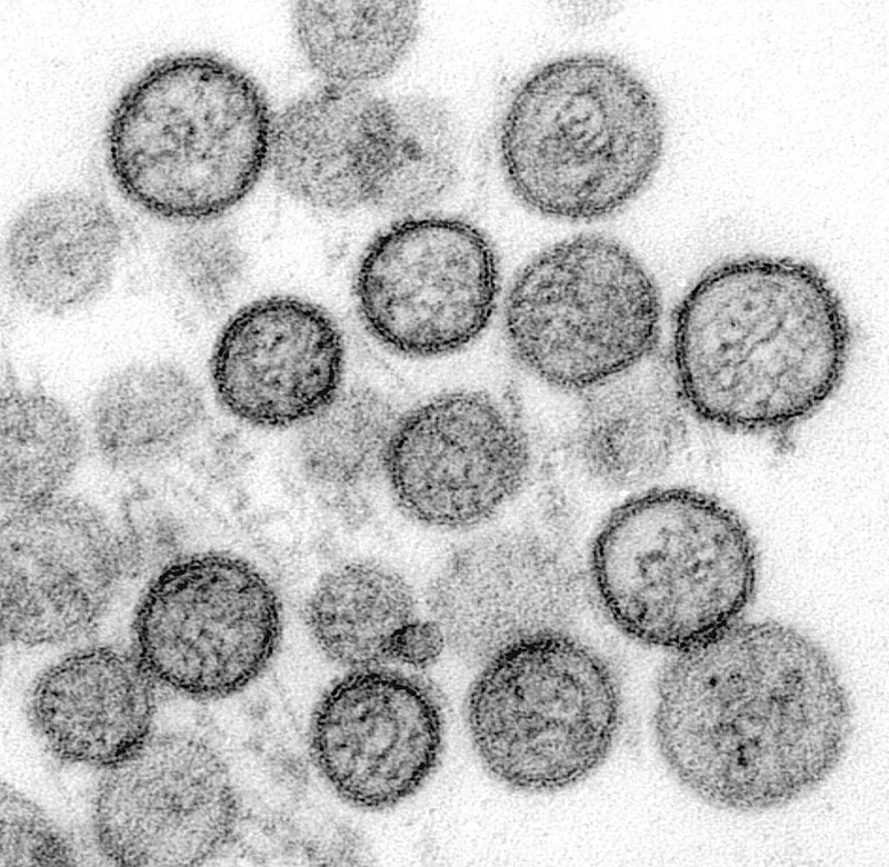 Orthohantavirus Biology and Human Impact