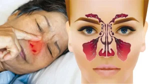 Respiratory diseases